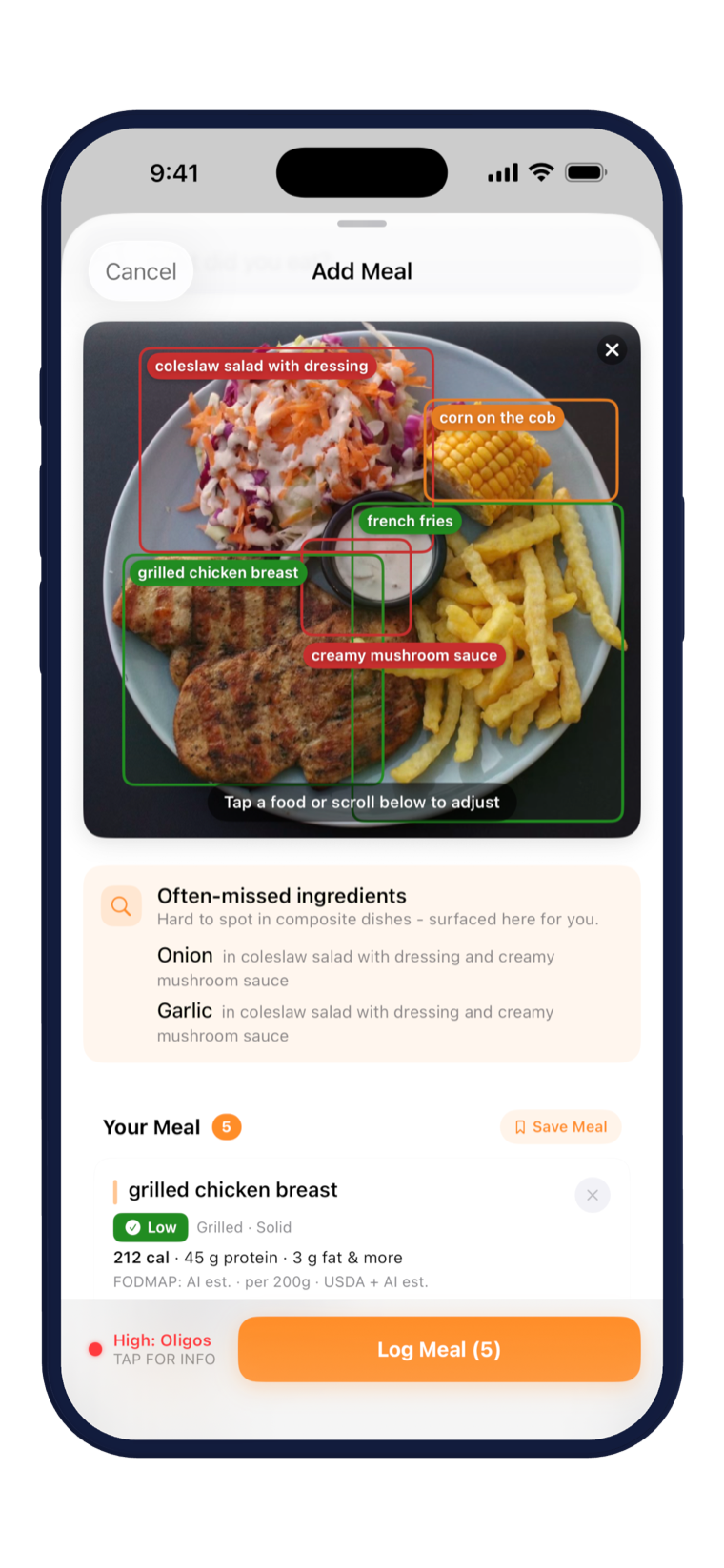 Tract meal logging with AI food-photo recognition